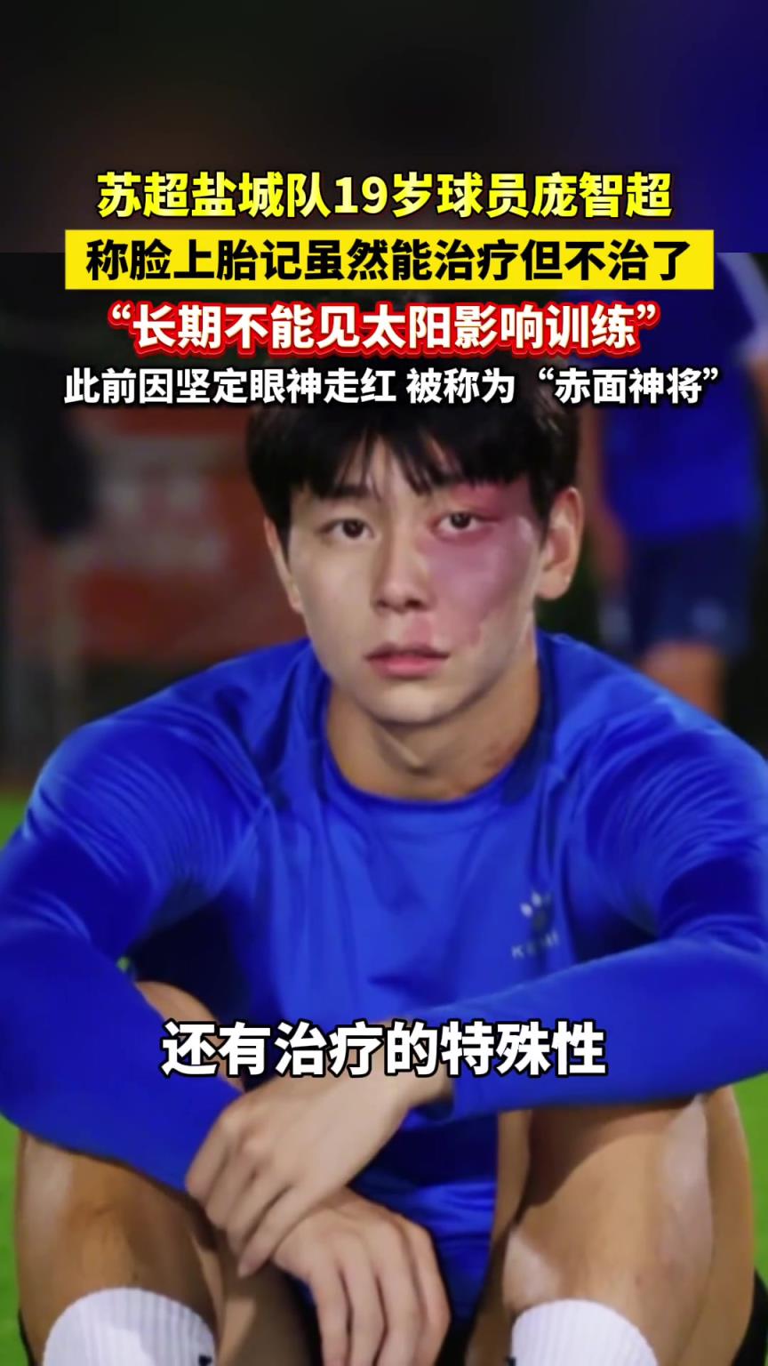 苏超盐城队“赤面神将”庞智超谈脸上胎记：能治疗，但不治了